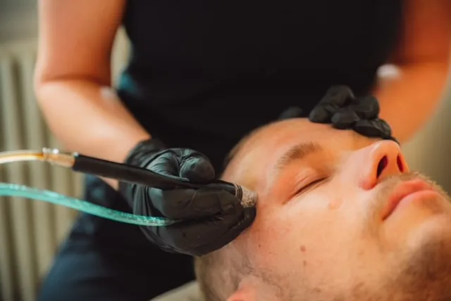 Foto fra VIDA Skønhedsklinik af en Silkpeel-behandling af ansigtet